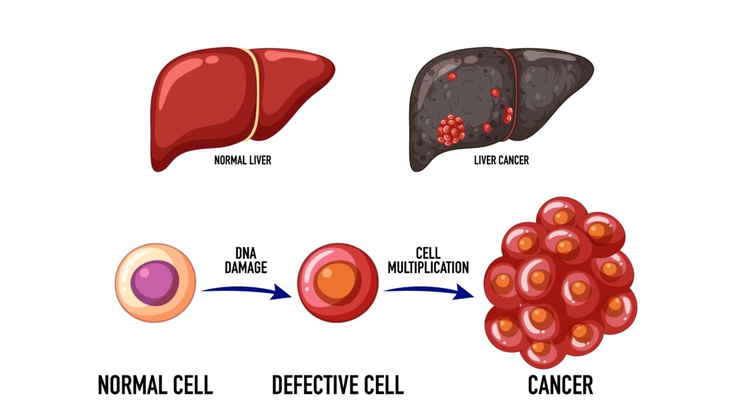 Process of Cancer Development